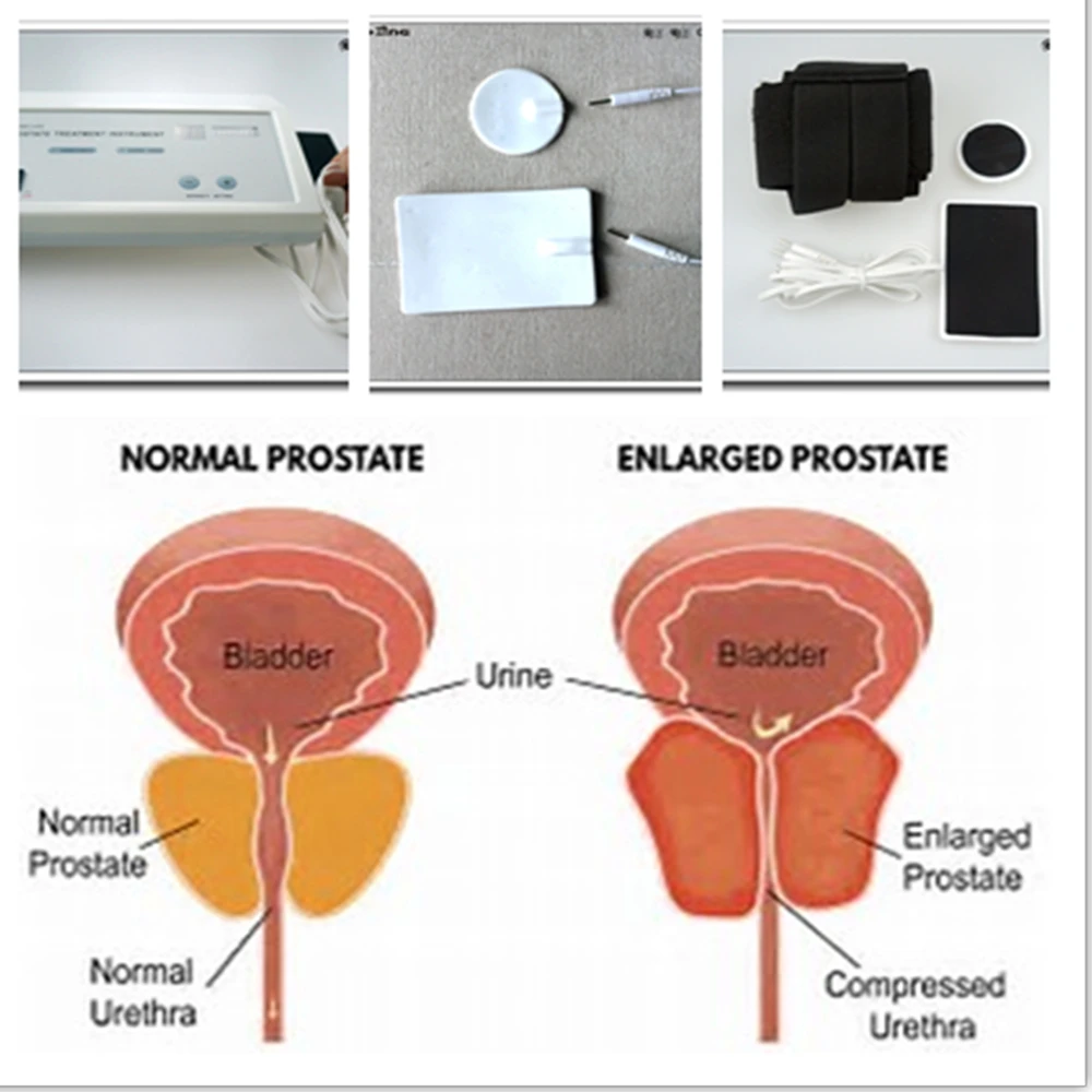 Leistungsstarker Prostata-Mass – Therapy Health And Wellness Bewertung und Preis